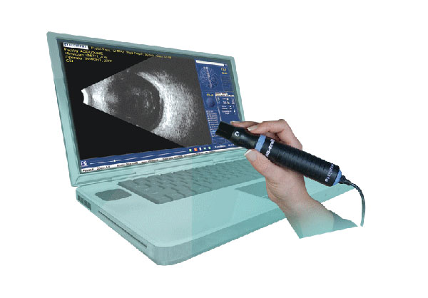 Accutome B-Scan Ultrason Probu